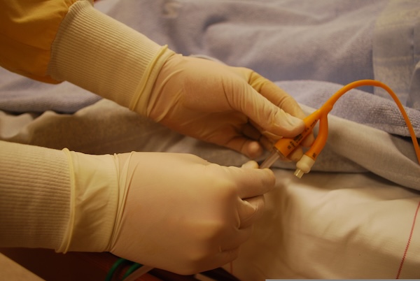 Gloved hands managing a catheter, a common trigger for autonomic dysreflexia after spinal cord injury