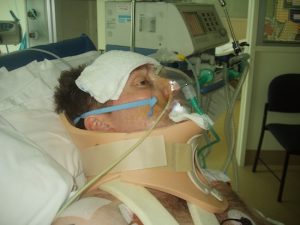 John Duthie in ICU wearing a neck brace and oxygen mask after his spinal cord injury